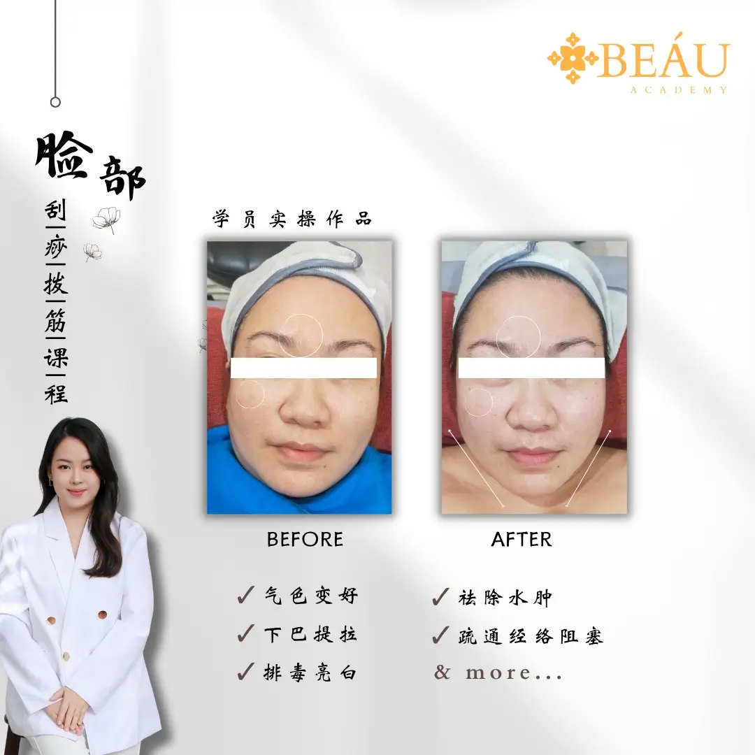 脸部拨筋提拉学员实操对比图（轮廓提升）。疗程后顾客下巴明显提拉紧致，脸部水肿消退，气色提亮变白。强有力的 Before & After 视觉冲击，是落地页中击中女性瘦脸痛点的最强转化催化剂。