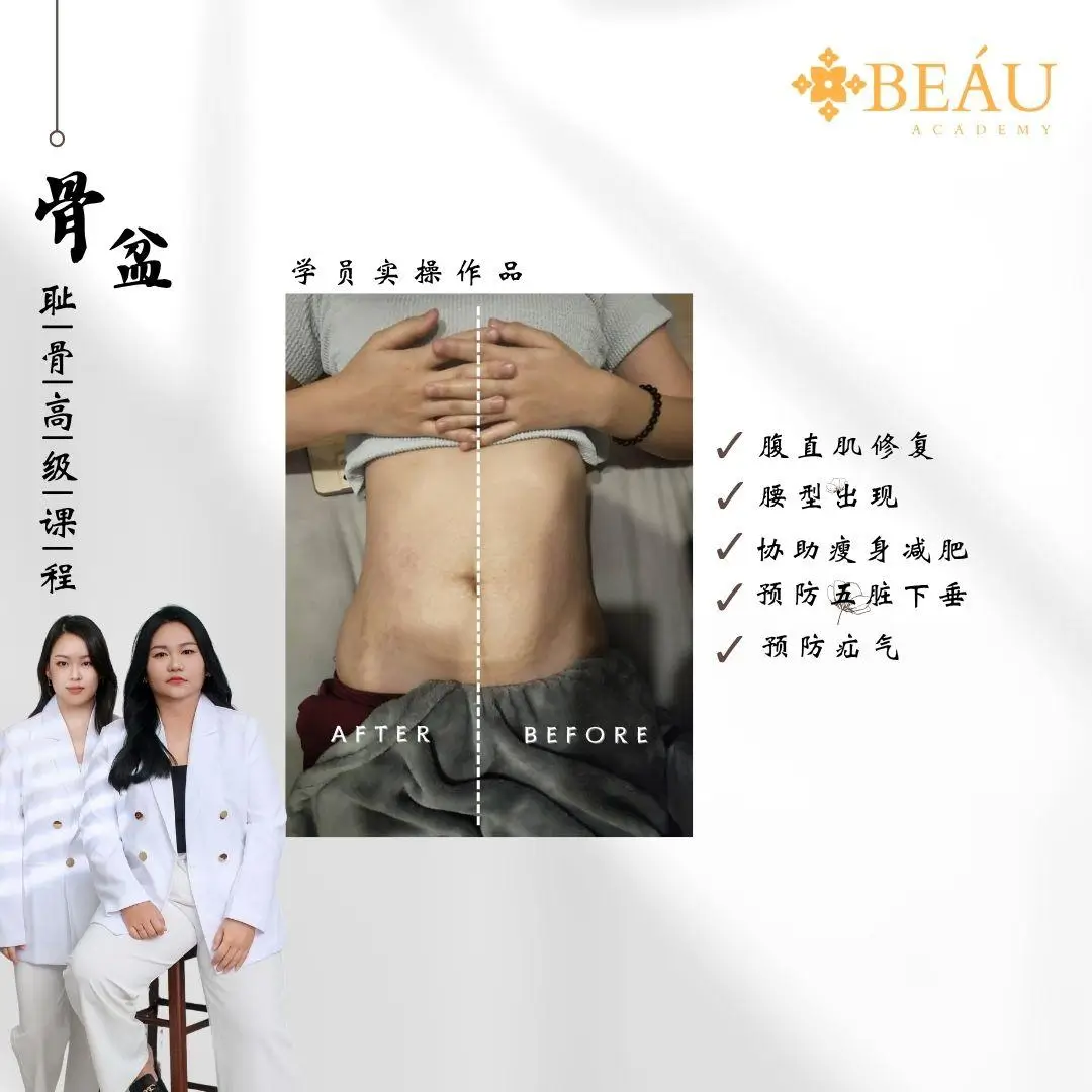 BEÁU Academy 学员徒手骨盆矫正真实实操对比：单次理疗即可实现腹直肌修复与腰线重塑，有效预防器官下垂，效果立竿见影。