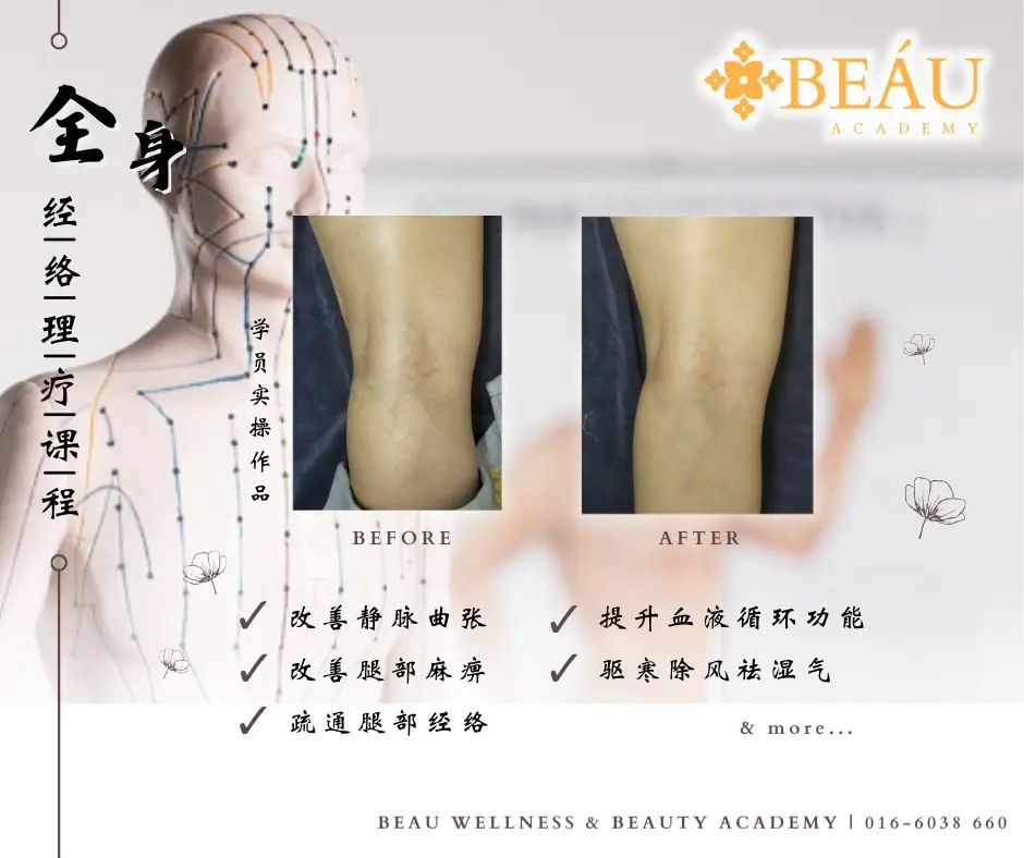 全身经络理疗课程学员实操前后对比图（Before & After）：针对腿部经络疏通，有效改善静脉曲张与腿部麻痹问题。